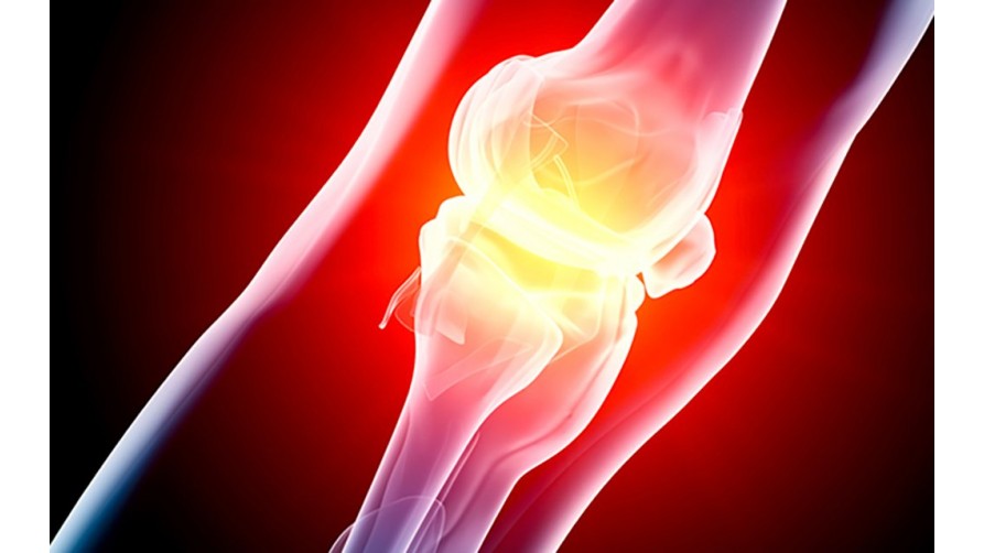 Can CBD be used for Arthritis relief?